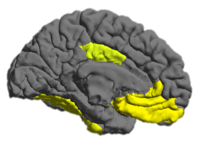 File:DepressionMDD medial.png