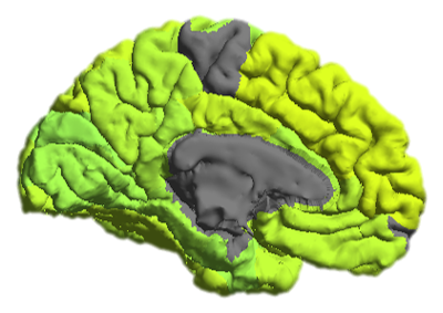 File:ADHD medial.png