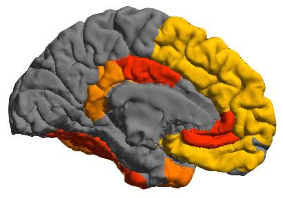 File:AddictionAlcohol medial.png